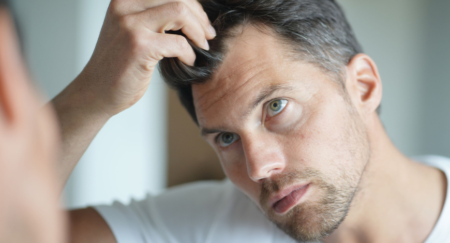 How to Stop Balding and Hair Loss in Young Men Naturally?